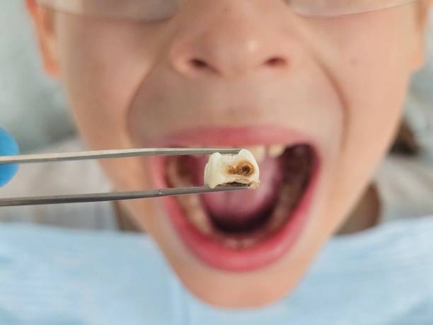 Best Emergency Root Canal Therapy in Broadway, VA